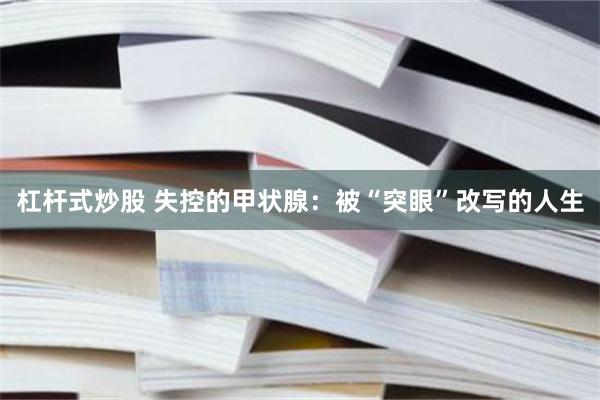 杠杆式炒股 失控的甲状腺：被“突眼”改写的人生